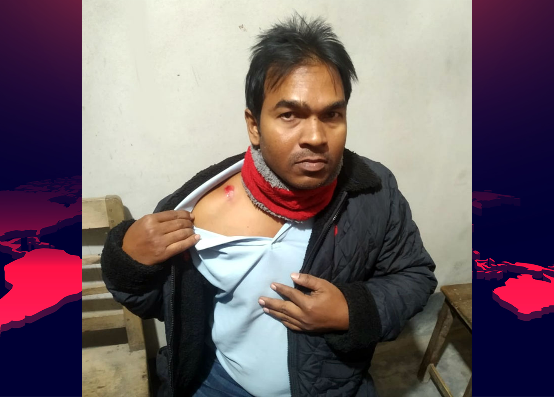 পরীক্ষার অযোগ্য বলায় শিক্ষককে হাতুড়িপেটা করে রক্তাক্ত করলো ছাত্রের পিতা