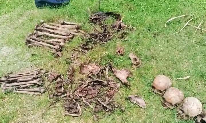 ময়লার স্তূপে মিলল মানুষের ৫টি মাথার খুলিসহ হাড়গোড়