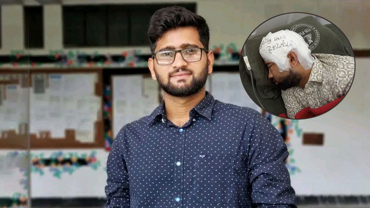 চবি সংঘর্ষ:  মামুনের মাথায় দুই মাস পর খুলি প্রতিস্থাপন