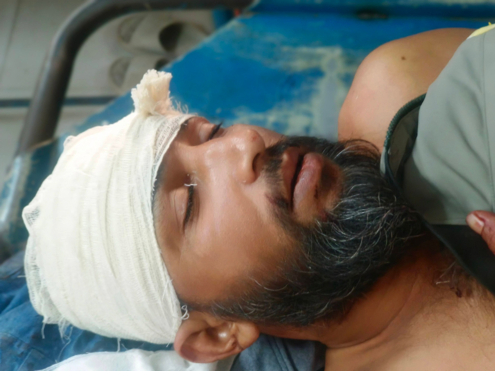 খুলনায় এনসিপি নেতাকে মাথায় গুলি