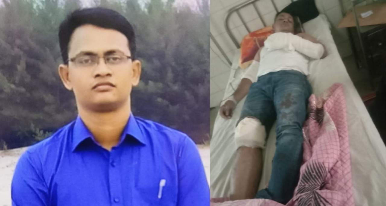 চাঁপাইনবাবগঞ্জে ডাকাতের ছুরিকাঘাতে এসআই আহত