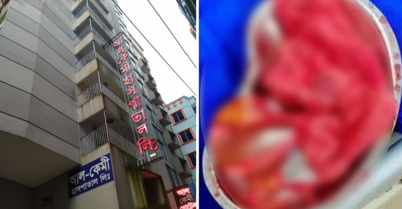 অপারেশনের ৭ মাস পর পেট থেকে গজ কাপড় উদ্ধার