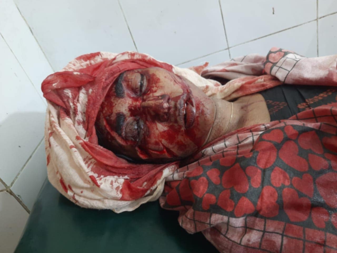 তালায় পারিবারিক কলহের জেরে স্ত্রীকে কোপালেন স্বামী