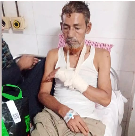 ভোলায় দু’পক্ষের সংঘর্ষে বিএনপি সভাপতি কবজি বিচ্ছিন্ন, আহত-২০