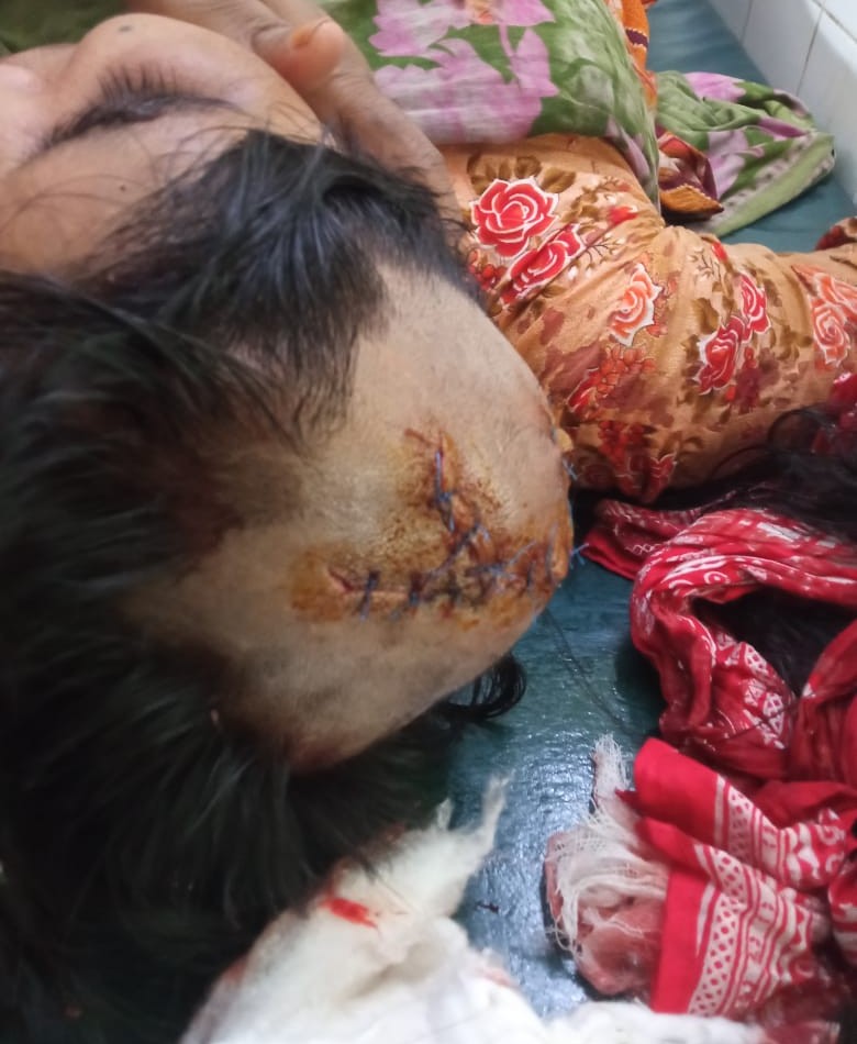 মোবাইল না দেওয়ায় স্ত্রীকে কুপিয়ে আহত