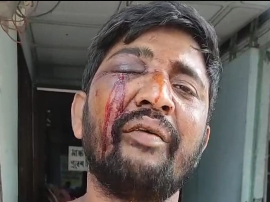 স্ত্রীর প্রেমিকের নির্যাতনে স্বামী আহত