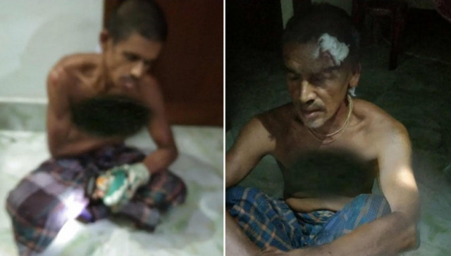 কালিগঞ্জে অস্ত্রের মুখে জিম্মি করে দূধর্ষ ডাকাতি, আহত-৩