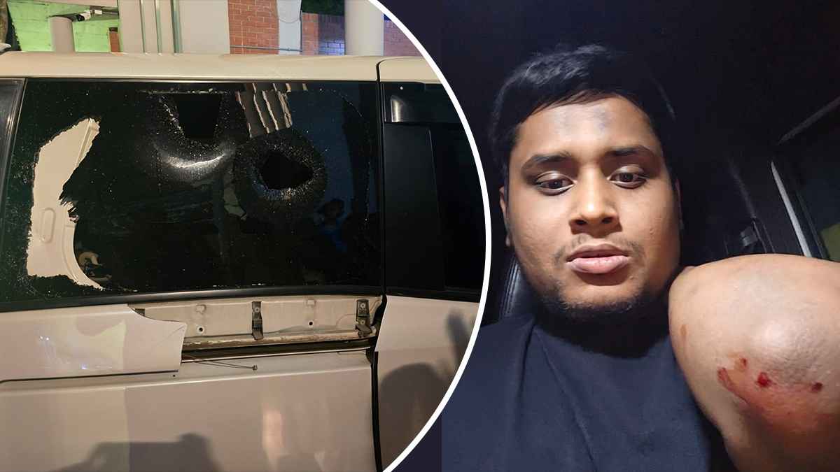 গাজীপুরে সন্ত্রাসী হামলায় রক্তাক্ত 
হাসনাত: সারজিস
