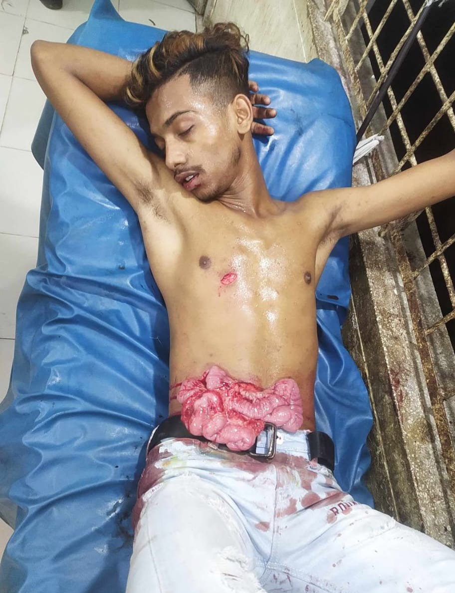 জাতিসংঘ পার্কে সন্ত্রাসীর ছুরিকাঘাতে এক যুবক গুরুতর আহত