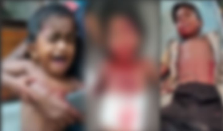 কুড়িয়ে পাওয়া ককটেল বিস্ফোরণে গুরুতর আহত ৩ ভাই-বোন